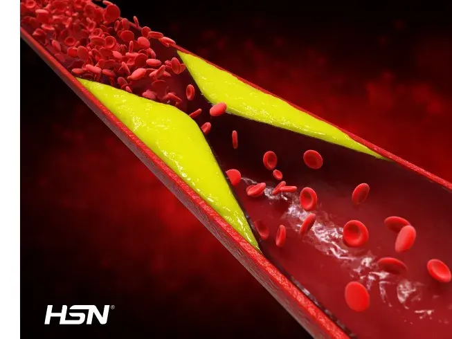 Cholesterol influence Cholesterol influence